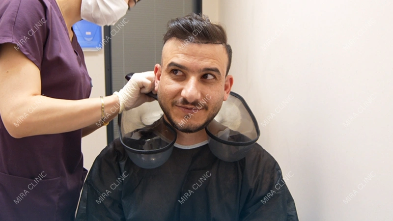 hair transplant procedure
